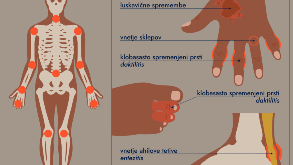 Biološka terapija za sve pacijente SBK kantona